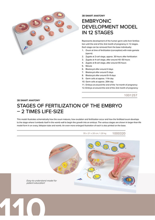 Fallopian Tube Model Label Ovaries & Fallopian Tubes Model with Stages of Fertilization, 2-times ...